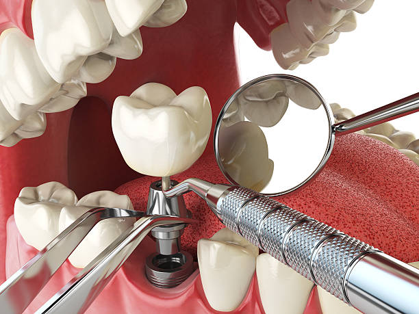 Best Broken or Chipped Tooth Repair in Maywood, NJ